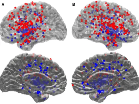 FIGURE 1  Electrode position in  standard MNI space. Entry (red dots) and  target (blue dots) points obtained from  each electrode for each patient (n = 37)  are displayed in the left (A) and right (B)  hemisphere
