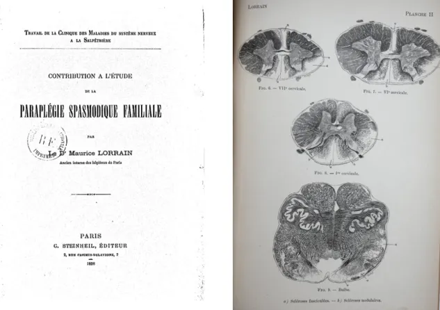 Figure 1. Original manuscript of Dr. Maurice Lorrain. Source: gallica.bnf.fr/Bibliothèque nationale de France