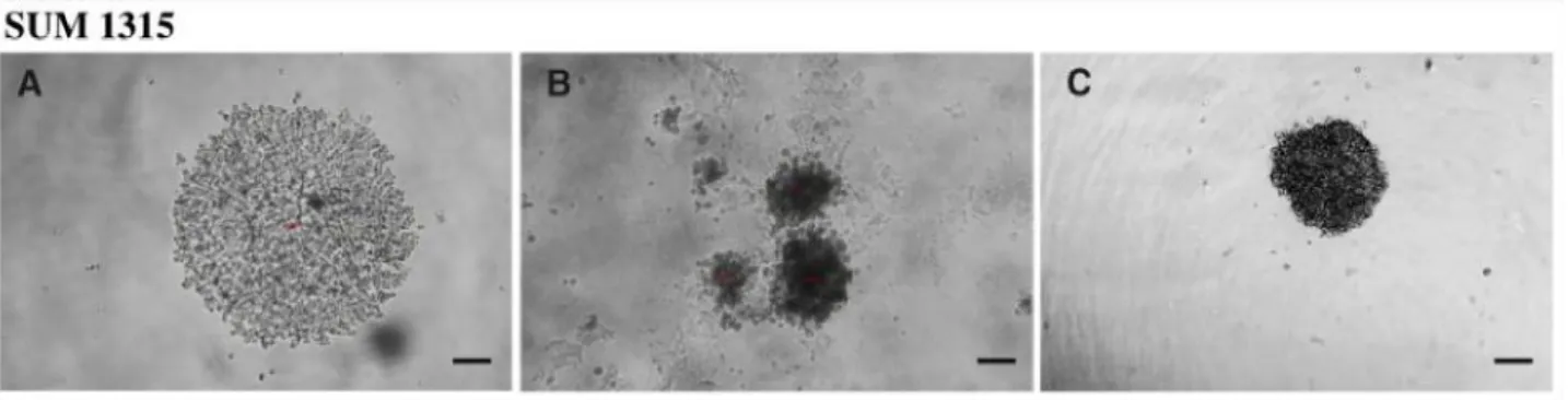 Figure 1: Profile of spheroid formation with the SUM1315 cell line in light microscopy