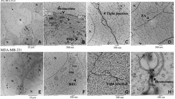 Figure 5: Ultrastructure of SUM1315 and MDA-MB-231 spheroids by Transmission Electron Microscopy (TEM)