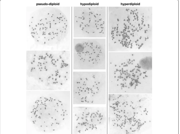 Figure 1 Metaphases of MDCK II cells. Pseudo-diploid metaphases (left) were from cells maintained one month in culture