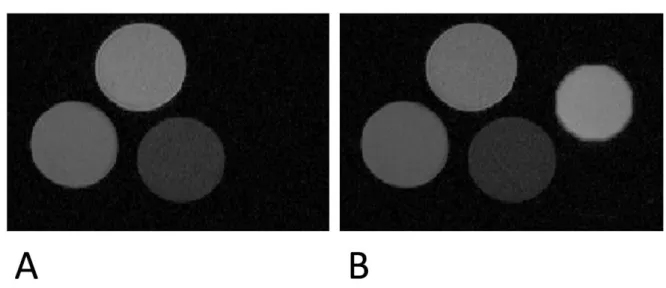 Figure 2. Proof of concept of Virtual Phantom (ViP) MRI. The MR image of three tubes filled   with agar + gadolinium at different concentrations (physical phantom) is shown in panel A