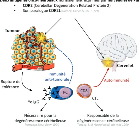 Figure 5 : Hypothèse qu’une rupture de tolérance immunitaire dans la tumeur est à l’origine des syndromes  neurologiques paranéoplasiques (Exemple de la Yo-DCP)