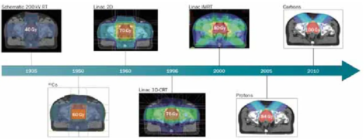 Figure 1.9 – L’escalade de dose. Augmentation de la dose prescrite à la prostate avec les avancées technologiques [203].