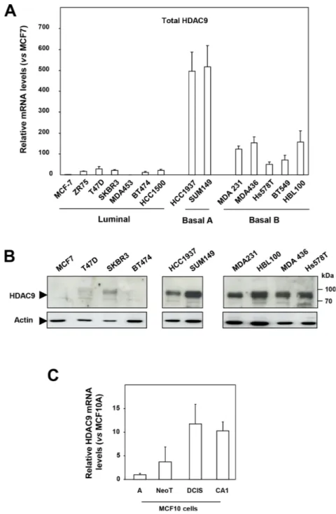 Figure 1: HDAC9 is overexpressed in the most aggressive breast cancer cells.  A. Total HDAC9 mRNA levels were measured  in fourteen breast tumor cell lines classified as luminal (n=7), basal A (n=2) and basal B (n=5)