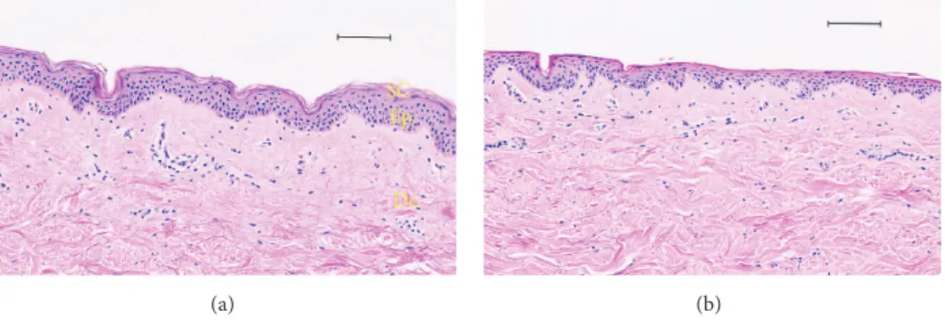 Figure 4: Histological analysis and comparison between a human skin tape-stripped and no treatment by optical microscopy (haematoxylin and eosin staining)
