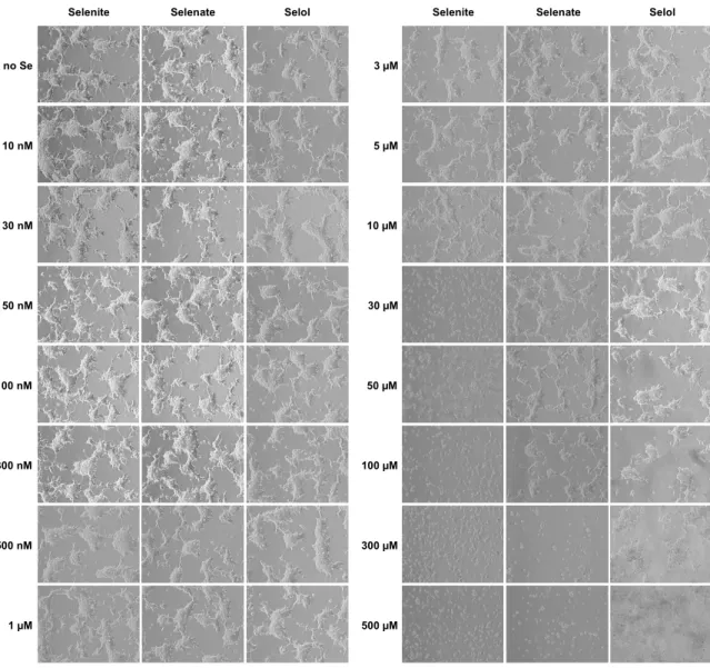 Figure 3. HEK293 morphology in response to various concentrations of three selenocompounds,  namely selenite, selenate and Selol