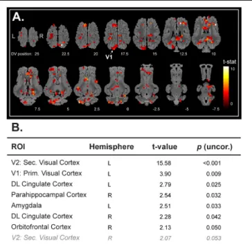 FIGURE 1 | (A) Horizontal maps of global brain BOLD responses to a visual stimulation (white flash, 8 Hz)
