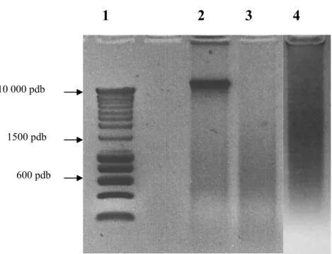 Figure 1: DNA quality determined by electrophoresis on a 1% agarose gel. Each sample  was compared to a ladder (1) and classified according to their smear as “highly 