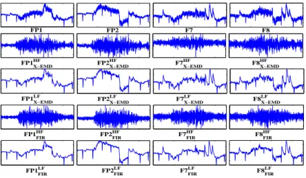 Figure 6: Application of X-EMD to multichannel sleep recording.