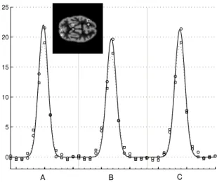 Fig. 10. Concatenated horizontal profiles of three small impulses obtained from WV-MAP-EM reconstructions with DWT (circles) and UDWT (squares).