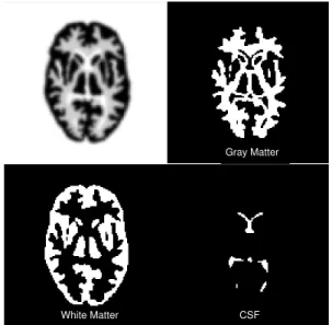 Fig. 2. The Hoffman brain phantom and the corresponding ROI regions used in our experimental studies.