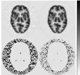 Fig. 5. Reconstructions of FBP, TV-MAP-EM (γ = 0 . 25 ), TIK-MAP-EM (γ = 1 . 0 ) and WV-MAP-EM (β = 1 