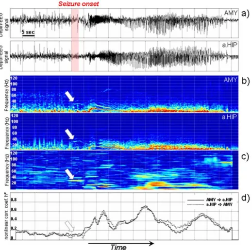 Figure 5. Results obtained on real data. a) Depth-EEG signals recorded from amygdala (AMY) and hippocampus (HIP) in human during transition to seizure activity in  tem-poral lobe epilepsy
