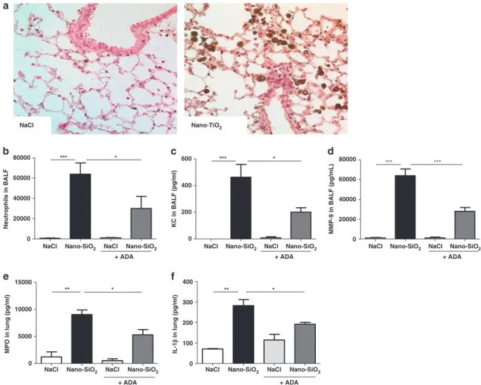 Figure 8 Pulmonary inflammation upon instillation of nanoparticles is partially dependent on adenosine production