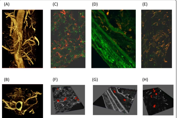 Figure 6 Imaging the vasa vasorum. Micro CT and confocal microscopy were used to image the vasa vasorum (A) Mice were anesthetized, heparinized and perfused