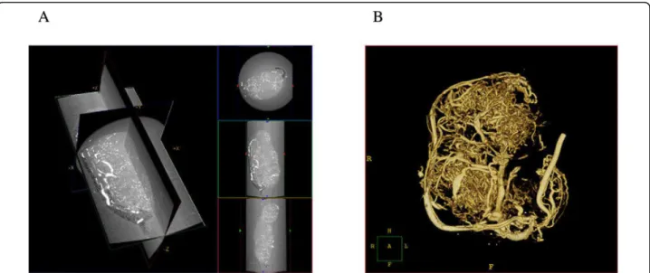 Figure 2 Examples of different micro-CT applications: A) atherosclerotic plaque and vasa vasorum in the descending aorta in mice, and B) vascular tree of a mouse kidney.