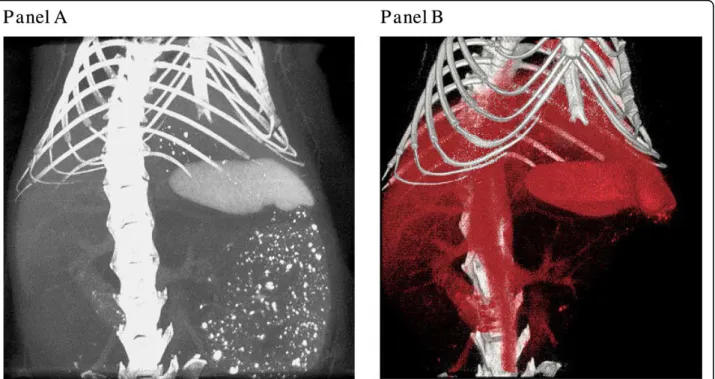 Figure 4 In vivo micro-CT of a mouse injected with 0.4 mL of Fenestra VC. A maximum intensity projection is shown in A and its volume rendering in B