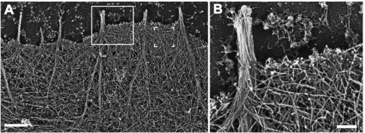 Figure 8 Platinum replica electron microscopy of the lamellipodia of B16F1 cell . 