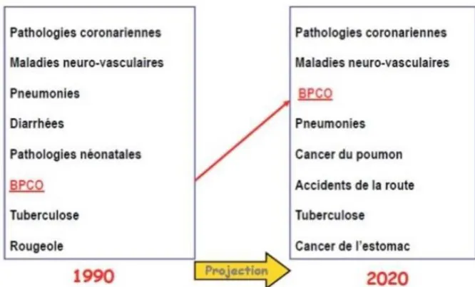Figure 1. La BPCO va devenir la 3éme cause de mortalité dans le monde. 