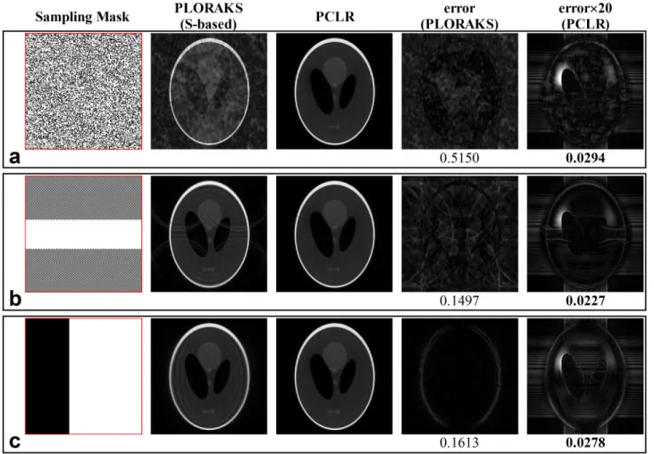 FIGURE 9. Reconstruction results for the Shepp-Logan phantom. a: Random sampling. b: Structured sampling