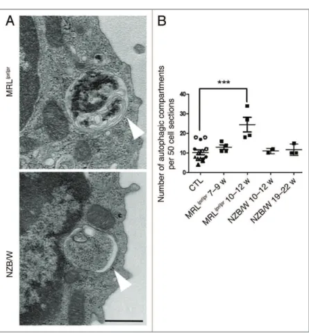 Figure 3. Increased number of autophagic vacuoles in peripheral T cells isolated from lupus mice compared with control mice.