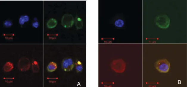 FIGURE 6. Confocal microscopy of dendritic cells after a short time (A) or 24-h (B) incubation with siRNA–TAMRA-loaded micelles formulated with PLL–FITC.