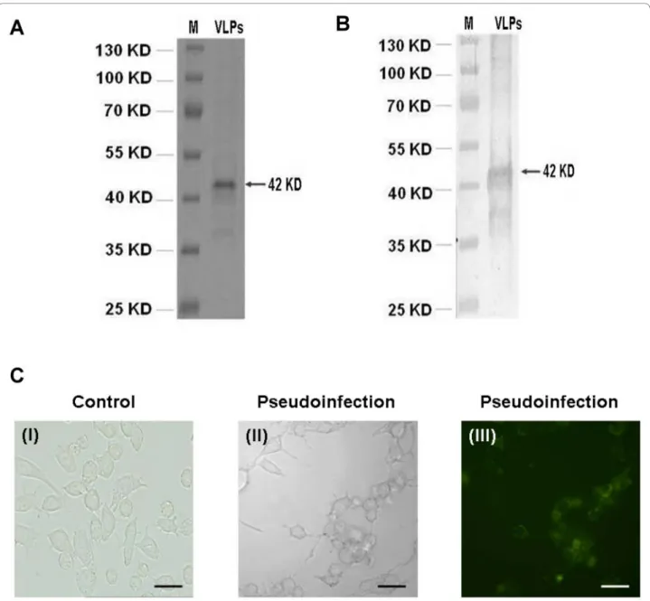 Figure 1 Purification of JCV virus-like particles (VLPs). Recombinant JCV VLPs protein in yeast cells was purified and identified by SDS-PAGE (A)  and Western blot (B)