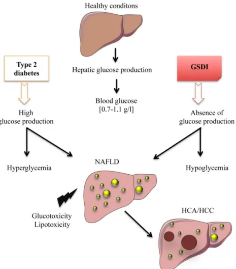 FIGURE  1:  Deregulation  of  endoge- endoge-nous  glucose  production  leads  to  hepatic  complications