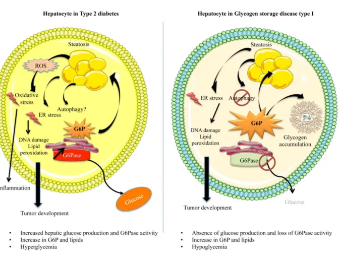 FIGURE 2: Dysfunction of hepatocyte metabolism in type 2 diabetes and GSDI leads to cell stress