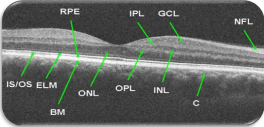 Fig. 3: A representation of the 10 layers in the retina's OCT image [6]  