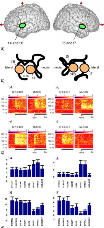 Figure 4. Functional dissociation between regions of the mid portion of the superior temporal gyrus in response to speech and music