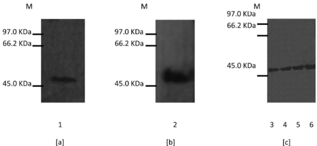 Fig. 2. Western blots with the 35C1 antibody on cell line and puri ﬁ ed recombinant human His-Aurora-A protein