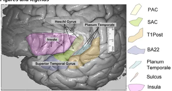 Fig. 1 (color): Areas of the human cortex (left hemisphere here) showing an activity in  response to amplitude modulated white noise