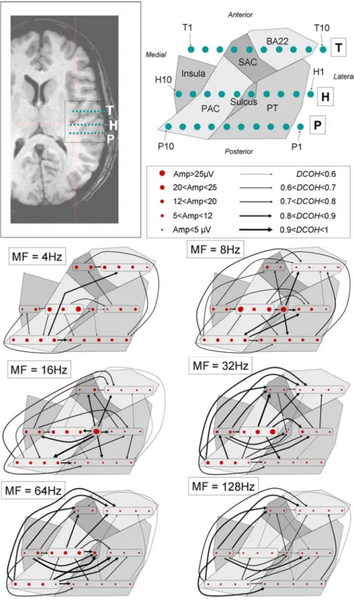 Fig. 9: Schemes of temporal envelope processing revealed by the three electrodes T, H and  P implanted in the right hemisphere of subject M