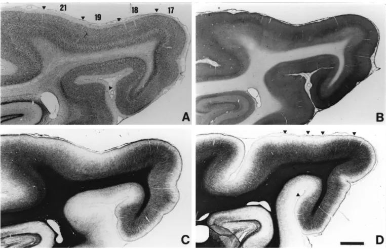 Figure 2. Architecture of areas 17, 18, 19 and 21. Photomicrographs of adjacent parasagittal sections stained with cresyl violet (A), CO (B) and myelin (C)