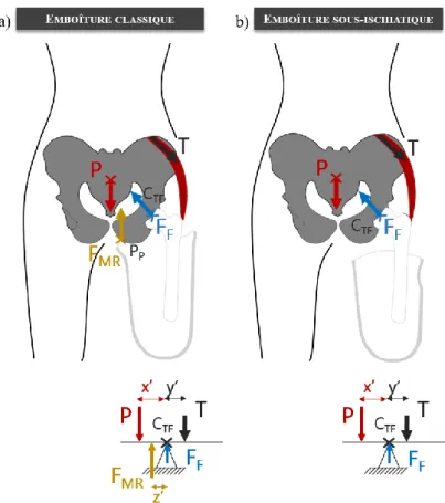 Figure 19 : Actions mécaniques agissant sur le moment d'abduction de la hanche pour les emboîtures classiques  (quadrilatérale ou à ischion intégré) (a) et une emboîture sous ischiatique (b)