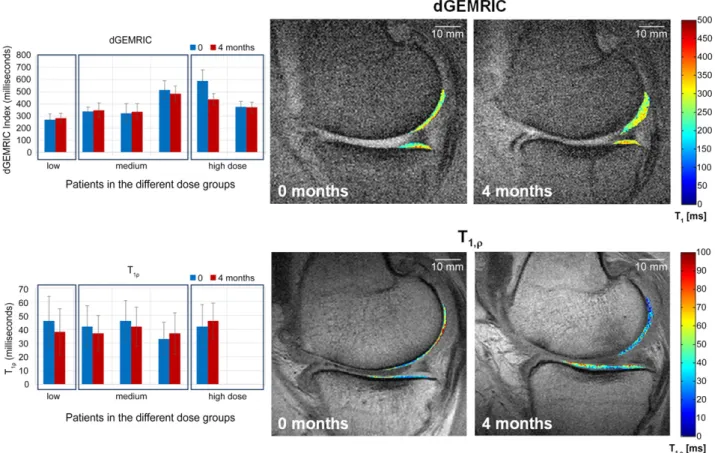 Figure 3. dGEMRIC and T 1rho magnetic resonance imaging (MRI) of selected patients. The graphs on the left show the dGEMRIC (n = 6) and T 1rho