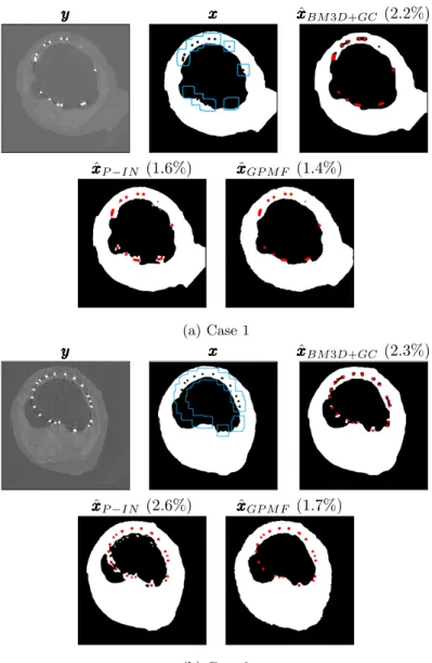 Figure 2.7.: Unsupervised segmentations of organic material in corrupted X- X-rays images