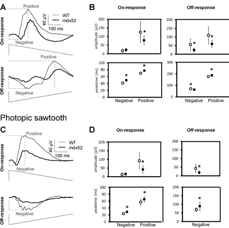 Fig. 3. Sawtooth On- and Off-responses. (A) Averaged responses of On- and Off-mediated mesopic ERG responses of mdx52 (bold traces) and WT (thin traces) mice