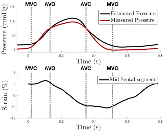 Figure 2: Example of a comparison of pressure curves (upper panel) and the corresponding  observed strain trace (lower panel)