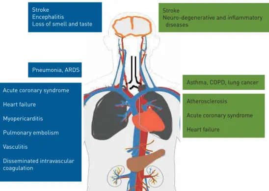 FIGURE 1 Target organs and the main diseases that coronavirus disease 2019 (blue) and air pollution (green) share