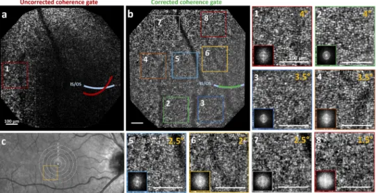 Fig. 4. Foveal cone mosaic images of subject S1 as close as 1 o from the foveal center (yellow square of the retinal fundus image)