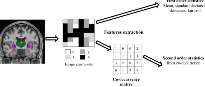 Figure 6.  Texture features extraction scheme. For each brain structure represented as a region of interest  segmented on the T1w MR images, gray levels variation is captured without taking into account voxels  neighbouring using first order statistics and