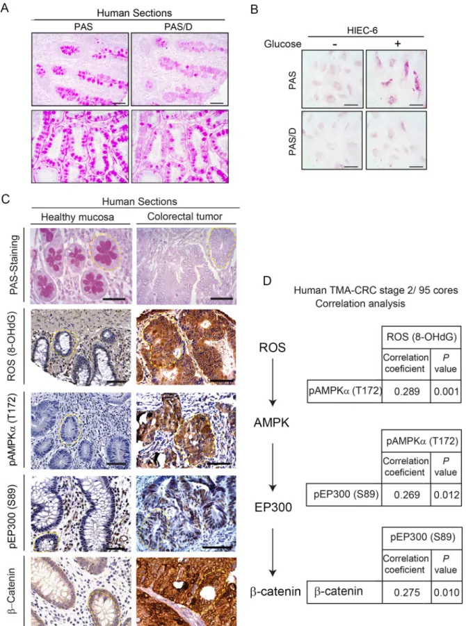 Fig 7. Clinical relevance of the ROS/AMPK/EP300/β-catenin axis in human colorectal cancer