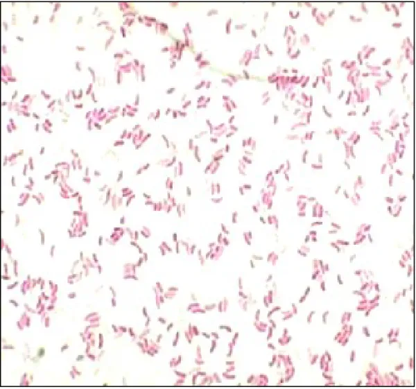 Figure 5 : Examen direct des selles avec coloration Gram × 1000   ource    ttp        .microbe-edu.org etudiant vibrio