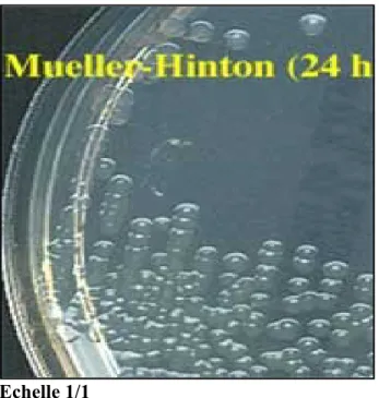 Figure 11 : Aspect des colonies de vibrions cholériques sur de la gélose Mueller-Hinton