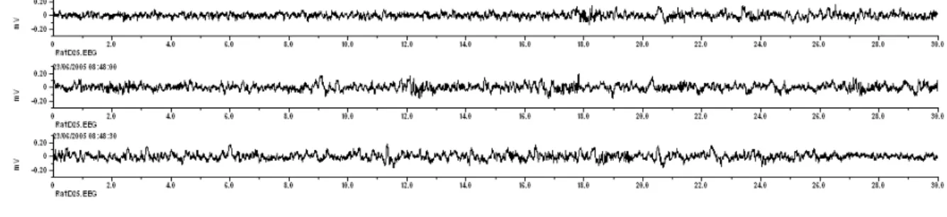 Figure 10 : Tracé EEG de base avant injection de pilocarpine chez un rat 