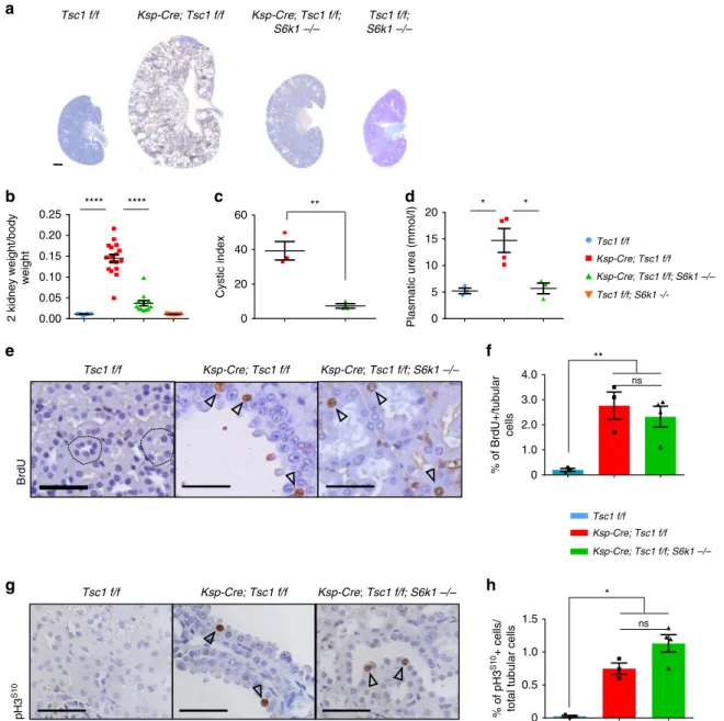 Fig. 1 S6K1 deletion protects from cyst formation in a mouse model of renal TSC without affecting proliferation