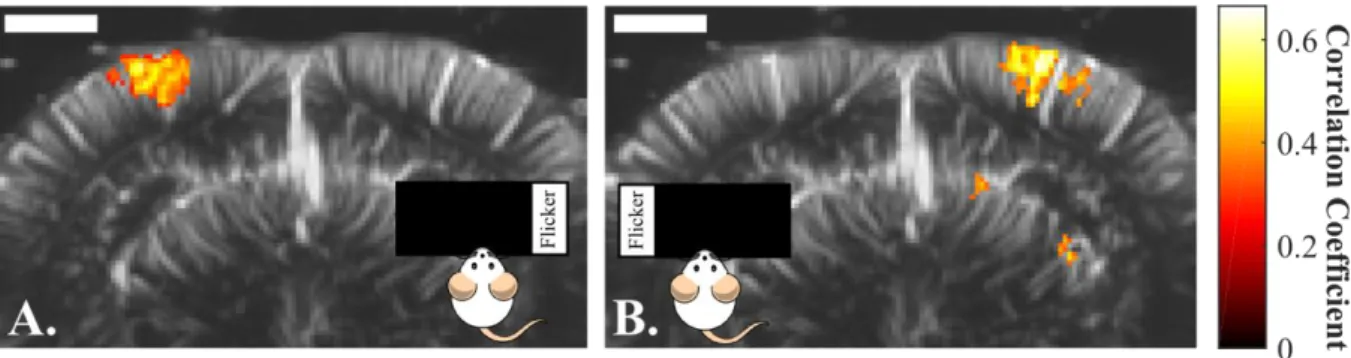 Figure  4  :  Visualization  by  fUS  of  the  lateralization  of  the  visual  response  in  the  visual  cortex:  A